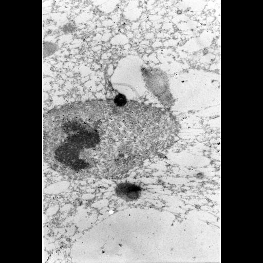  NCBI Organism:Paramecium tetraurelia; Cell Types:cell by organism, eukaryotic cell, , ; Cell Components:micronucleus, cytoplasm, cytoplasmic microtubule; Biological process:micronucleus organization, cytoplasm organization;