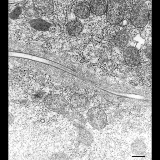  NCBI Organism:Paramecium multimicronucleatum; Cell Types:cell by organism, eukaryotic cell, , ; Cell Components:contractile vacuole, , cytoplasm; Biological process:contractile vacuole organization, microtubule-based process, cytoplasm organization;