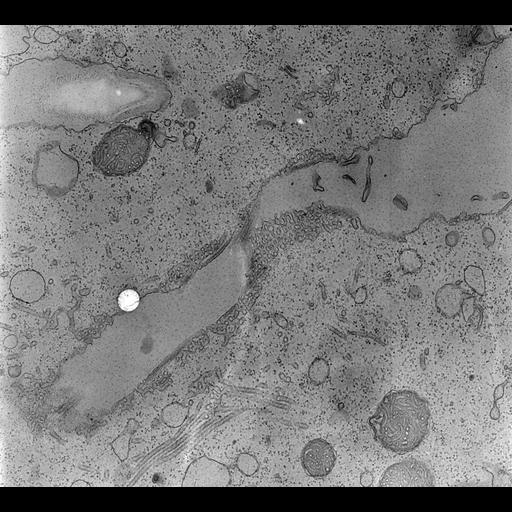  NCBI Organism:Paramecium multimicronucleatum; Cell Types:cell by organism, eukaryotic cell, , ; Cell Components:contractile vacuole, cytoplasmic membrane-bounded vesicle, contractile vacuolar membrane, intrinsic to contractile vacuolar membrane, contractile vacuole; Biological process:contractile vacuole organization, contractile vacuole discharge;