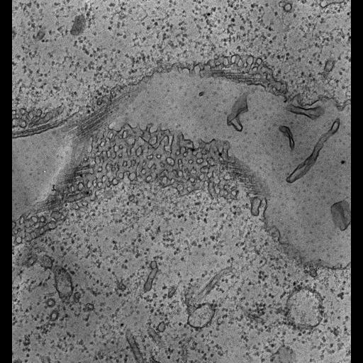  NCBI Organism:Paramecium multimicronucleatum; Cell Types:cell by organism, eukaryotic cell, , ; Cell Components:contractile vacuolar membrane, integral to contractile vacuolar membrane, intrinsic to contractile vacuolar membrane, cytoplasmic microtubule; Biological process:contractile vacuole organization, cytoplasmic microtubule organization;