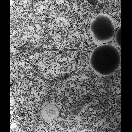  NCBI Organism:Paramecium multimicronucleatum; Cell Types:cell by organism, eukaryotic cell, , ; Cell Components:contractile vacuolar membrane, integral to contractile vacuolar membrane, intrinsic to contractile vacuolar membrane; Biological process:contractile vacuole organization, contractile vacuole discharge;