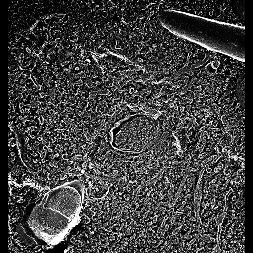  NCBI Organism:Paramecium multimicronucleatum; Cell Types:cell by organism, eukaryotic cell, , ; Cell Components:contractile vacuole, contractile vacuolar membrane, cytoplasm; Biological process:contractile vacuole organization, cytoplasm organization;