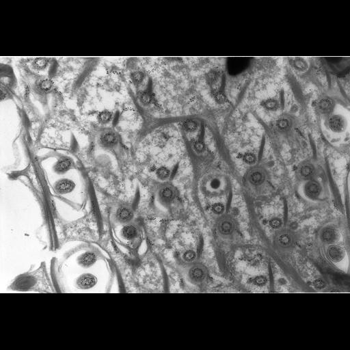  NCBI Organism:Paramecium tetraurelia; Cell Types:cell by organism, eukaryotic cell, , ; Cell Components:cell cortex, cortical microtubule cytoskeleton, cortical microtubule, microtubule basal body, axonemal microtubule; Biological process:microtubule cytoskeleton organization