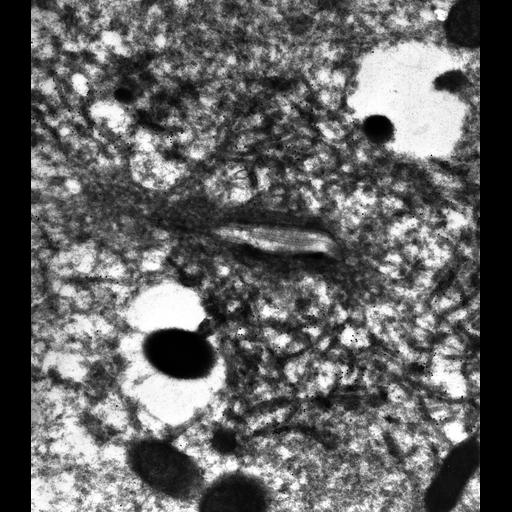  NCBI Organism:Paramecium multimicronucleatum; Cell Types:cell by organism, eukaryotic cell, , ; Cell Components:contractile vacuole, contractile vacuolar membrane; Biological process:contractile vacuole organization