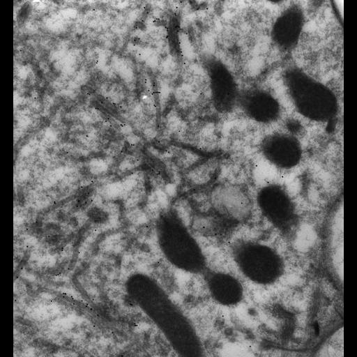  NCBI Organism:Paramecium multimicronucleatum; Cell Types:cell by organism, eukaryotic cell, , ; Cell Components:contractile vacuole, contractile vacuolar membrane; Biological process:contractile vacuole organization, ;