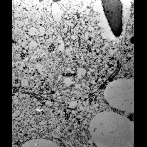  NCBI Organism:Paramecium multimicronucleatum; Cell Types:cell by organism, eukaryotic cell, , ; Cell Components:contractile vacuole, contractile vacuolar membrane, cytoplasmic microtubule; Biological process:contractile vacuole organization