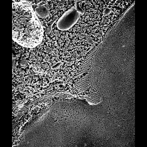  NCBI Organism:Paramecium multimicronucleatum; Cell Types:cell by organism, eukaryotic cell, , ; Cell Components:contractile vacuole, contractile vacuolar membrane; Biological process:contractile vacuole organization