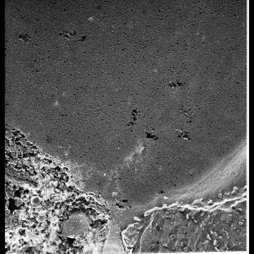  NCBI Organism:Paramecium multimicronucleatum; Cell Types:cell by organism, eukaryotic cell, , ; Cell Components:contractile vacuole, contractile vacuolar membrane; Biological process:contractile vacuole organization