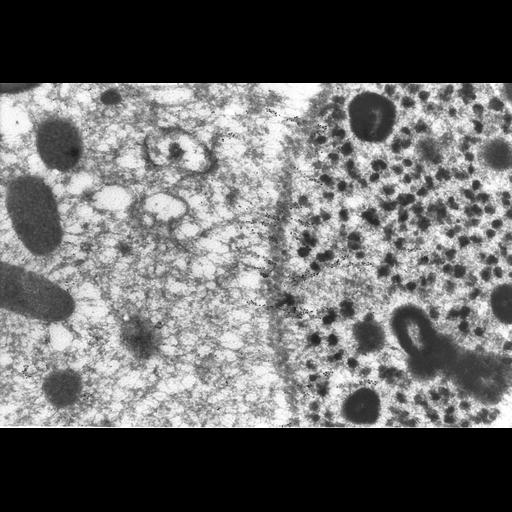  NCBI Organism:Paramecium tetraurelia; Cell Types:cell by organism, eukaryotic cell, , ; Cell Components:macronucleus, nuclear microtubule; Biological process:nuclear division, microtubule-based process, microtubule-based movement;