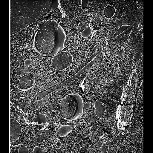  NCBI Organism:Paramecium multimicronucleatum; Cell Types:cell by organism, eukaryotic cell, , ; Cell Components:contractile vacuole, contractile vacuolar membrane, integral to contractile vacuolar membrane; Biological process:contractile vacuole organization