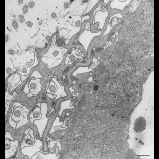  NCBI Organism:Paramecium multimicronucleatum; Cell Types:cell by organism, eukaryotic cell, , ; Cell Components:cytoproct, cell cortex, cytoplasm; Biological process:cortical cytoskeleton organization