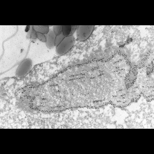  NCBI Organism:Paramecium tetraurelia; Cell Types:cell by organism, eukaryotic cell, , ; Cell Components:micronucleus, nuclear envelope, nuclear microtubule; Biological process:nuclear division, microtubule-based process, microtubule-based process;