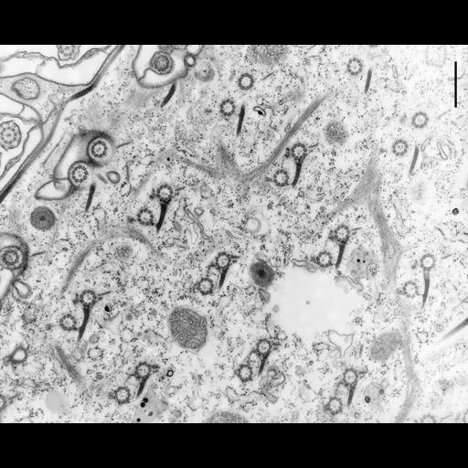  NCBI Organism:Paramecium multimicronucleatum; Cell Types:cell by organism, eukaryotic cell, , ; Cell Components:cell cortex, microtubule basal body, , microtubule, trichocyst; Biological process:cortical microtubule organization, microtubule cytoskeleton organization, , microtubule basal body organization;