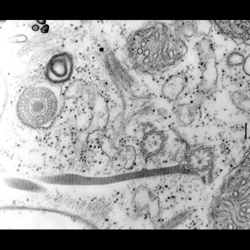  NCBI Organism:Paramecium multimicronucleatum; Cell Types:cell by organism, eukaryotic cell, , ; Cell Components:cortical cytoskeleton, microtubule basal body, trichocyst; Biological process:cortical cytoskeleton organization, , microtubule basal body organization;