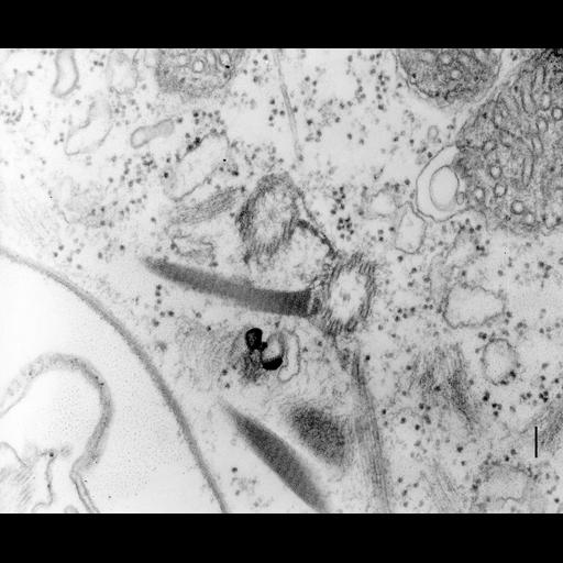  NCBI Organism:Paramecium multimicronucleatum; Cell Types:cell by organism, eukaryotic cell, , ; Cell Components:cell cortex, microtubule basal body, microtubule, ; Biological process:cortical cytoskeleton organization, microtubule basal body organization, ;