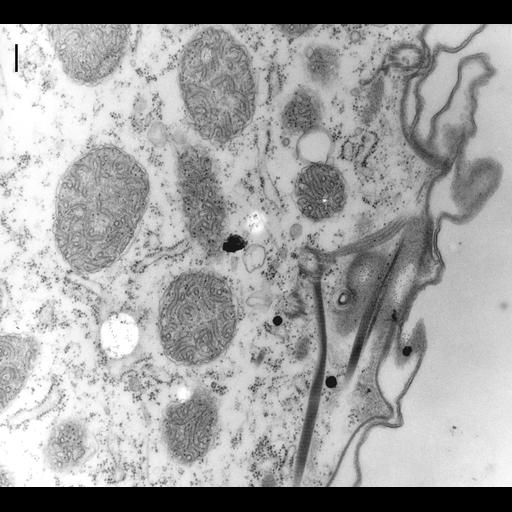  NCBI Organism:Paramecium multimicronucleatum; Cell Types:cell by organism, eukaryotic cell, , ; Cell Components:cell cortex, microtubule basal body, microfibril, , microtubule; Biological process:cortical cytoskeleton organization