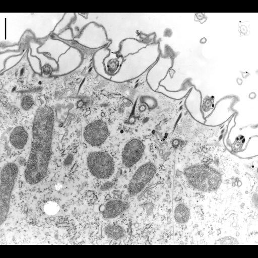  NCBI Organism:Paramecium multimicronucleatum; Cell Types:cell by organism, eukaryotic cell, , ; Cell Components:cell cortex, cortical cytoskeleton, trichocyst, microtubule basal body, cytoplasm; Biological process:cortical cytoskeleton organization, cytoplasm organization, ;