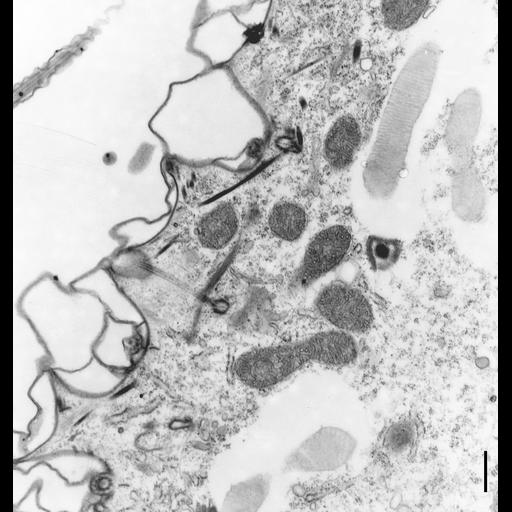  NCBI Organism:Paramecium multimicronucleatum; Cell Types:cell by organism, eukaryotic cell, , ; Cell Components:cell cortex, trichocyst; Biological process:cortical cytoskeleton organization, ;