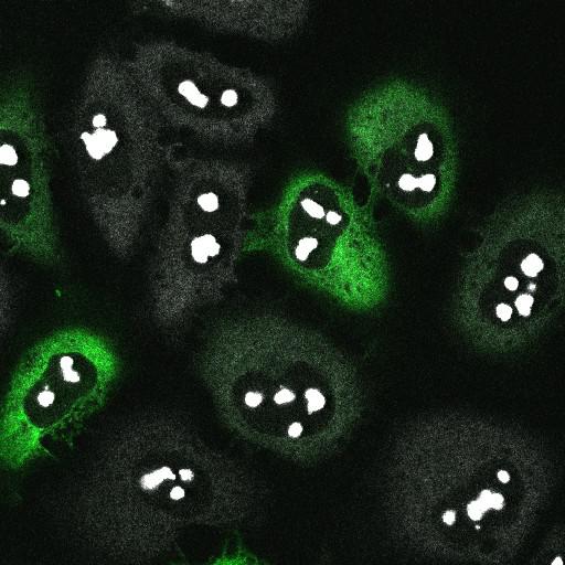  NCBI Organism:Homo sapiens; Cell Components:preribosome, small subunit precursor Biological process:maturation of SSU-rRNA