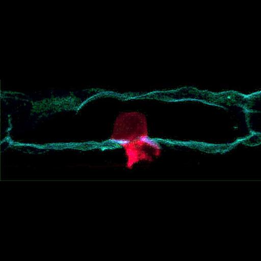  NCBI Organism:Caenorhabditis elegans; Cell Components:basement membrane