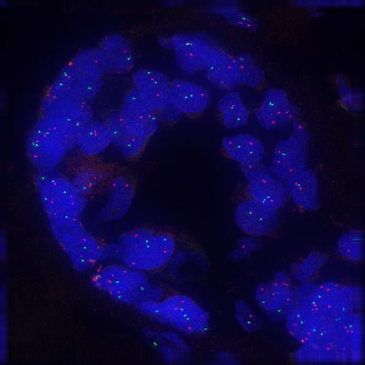  NCBI Organism:Homo sapiens; Cell Components:nuclear chromatin