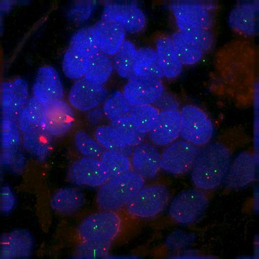  NCBI Organism:Homo sapiens; Cell Components:nuclear chromatin