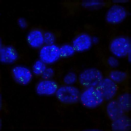  NCBI Organism:Homo sapiens; Cell Components:nuclear chromatin