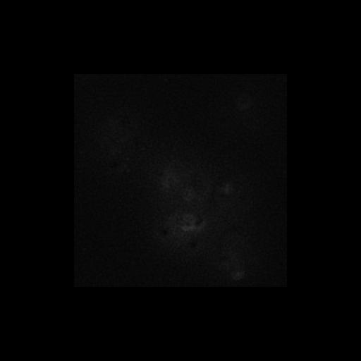  NCBI Organism:Saccharomyces cerevisiae S288c; Cell Components:Golgi apparatus, cytosol, extrinsic to membrane, nucleus, trans-Golgi network; Biological process:retrograde vesicle-mediated transport, Golgi to ER, protein localization in Golgi apparatus, protein transport, phosphatidylinositol-mediated signaling;