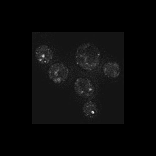  NCBI Organism:Saccharomyces cerevisiae S288c; Cell Components:Golgi apparatus, cytosol, extrinsic to membrane, nucleus, Golgi membrane; Biological process:retrograde vesicle-mediated transport, Golgi to ER, protein localization in Golgi apparatus, protein transport, regulation of signal transduction;