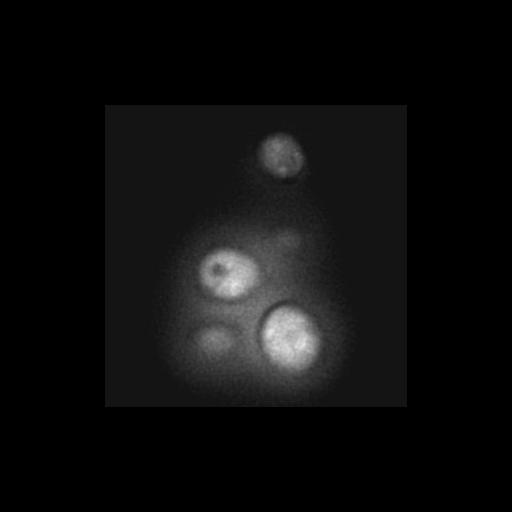  NCBI Organism:Saccharomyces cerevisiae S288c; Cell Components:Golgi apparatus, cytosol, extrinsic to membrane, nucleus; Biological process:retrograde vesicle-mediated transport, Golgi to ER, protein localization in Golgi apparatus, protein transport;