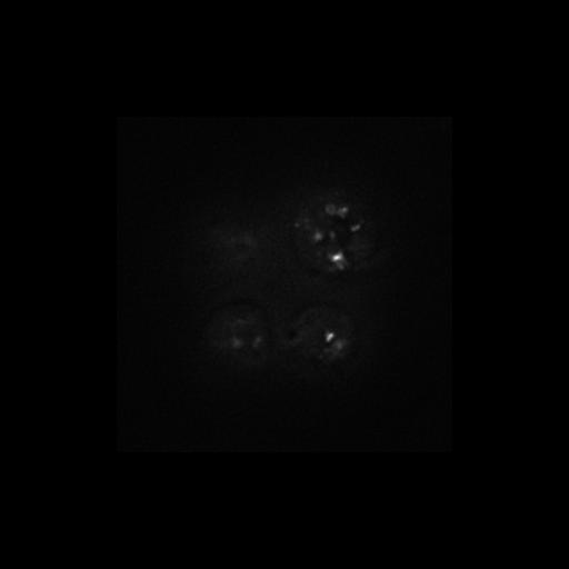  NCBI Organism:Saccharomyces cerevisiae S288c; Cell Components:Golgi apparatus, cytosol, extrinsic to membrane, nucleus; Biological process:retrograde vesicle-mediated transport, Golgi to ER, protein localization in Golgi apparatus, protein transport;