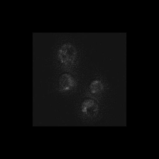  NCBI Organism:Saccharomyces cerevisiae S288c; Cell Components:Golgi apparatus, cytosol, extrinsic to membrane, nucleus, trans-Golgi network; Biological process:retrograde vesicle-mediated transport, Golgi to ER, protein localization in Golgi apparatus, protein transport, phosphatidylinositol-mediated signaling;