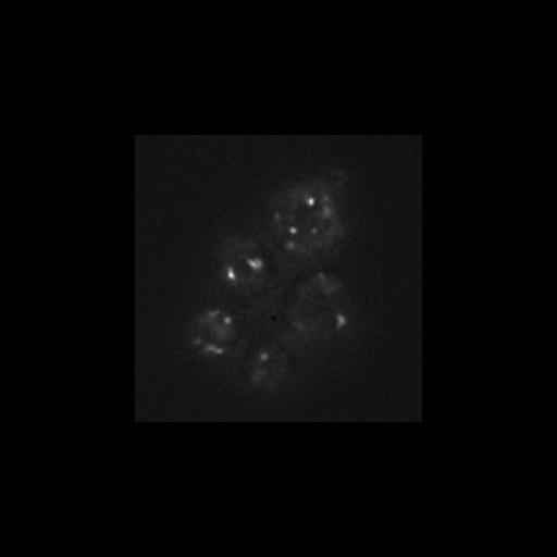  NCBI Organism:Saccharomyces cerevisiae S288c; Cell Components:Golgi apparatus, integral to membrane, vacuolar lumen, Golgi membrane; Biological process:cell wall mannoprotein biosynthetic process, protein glycosylation, regulation of signal transduction;