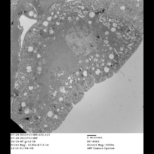  NCBI Organism:Drosophila melanogaster; Cell Types:garland cell Cell Components:nucleus, early endosome, late endosome; Biological process:endocytosis