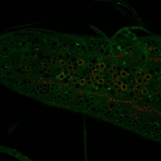  NCBI Organism:Drosophila melanogaster; Cell Types:motor neuron Cell Components:endosome Biological process:receptor-mediated endocytosis, endosome to lysosome transport, endosome transport;