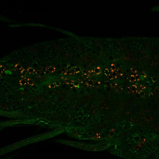  NCBI Organism:Drosophila melanogaster; Cell Types:motor neuron Cell Components:endosome Biological process:receptor-mediated endocytosis, endosome to lysosome transport, endosome transport;