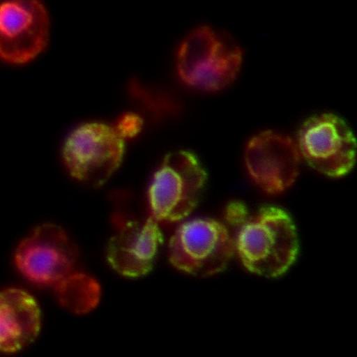  NCBI Organism:Saccharomyces cerevisiae; Cell Components:endoplasmic reticulum lumen, nucleus, endoplasmic reticulum membrane, Hrd1p ubiquitin ligase ERAD-M complex, Hrd1p ubiquitin ligase ERAD-L complex; Biological process:SRP-dependent cotranslational protein targeting to membrane, translocation, response to unfolded protein, ER-associated protein catabolic process, endoplasmic reticulum unfolded protein response;