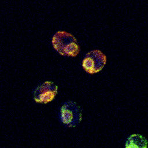  NCBI Organism:Saccharomyces cerevisiae; Cell Components:nucleus, endoplasmic reticulum lumen; Biological process:SRP-dependent cotranslational protein targeting to membrane, translocation, response to unfolded protein, endoplasmic reticulum unfolded protein response;