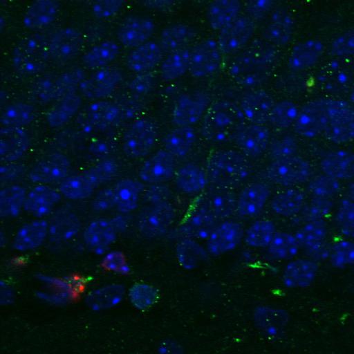  NCBI Organism:Mus musculus; Cell Types:neuronal stem cell Cell Components:nucleus Biological process:regulation of neurogenesis, regulation of neuron differentiation;