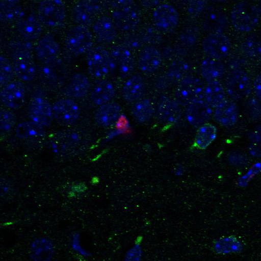  NCBI Organism:Mus musculus; Cell Types:neuronal stem cell Cell Components:nucleus Biological process:regulation of neurogenesis, regulation of neuron differentiation;