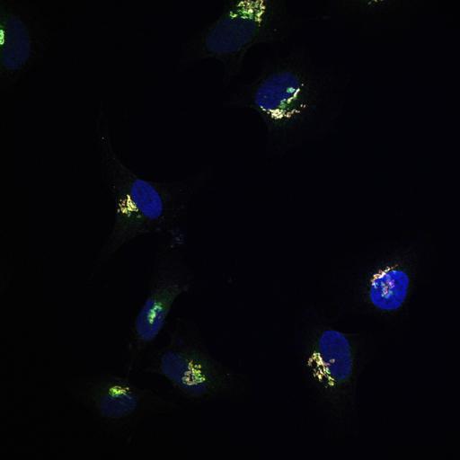  NCBI Organism:Homo sapiens; Cell Types:epithelial cell, ; Cell Components:Golgi stack, integral to membrane, Golgi cisterna membrane, nucleus; Biological process:Golgi organization, protein O-linked glycosylation via serine, protein O-linked glycosylation via threonine;