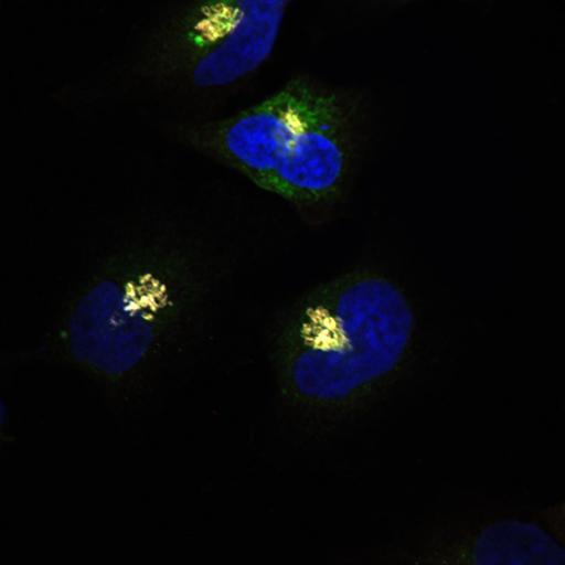  NCBI Organism:Homo sapiens; Cell Types:epithelial cell, ; Cell Components:Golgi stack, integral to membrane, Golgi cisterna membrane, nucleus; Biological process:Golgi organization, protein O-linked glycosylation via serine, protein O-linked glycosylation via threonine;