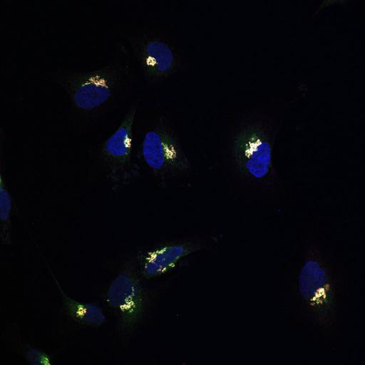  NCBI Organism:Homo sapiens; Cell Types:epithelial cell, ; Cell Components:Golgi stack, integral to membrane, Golgi cisterna membrane, nucleus; Biological process:Golgi organization, protein O-linked glycosylation via serine, protein O-linked glycosylation via threonine;