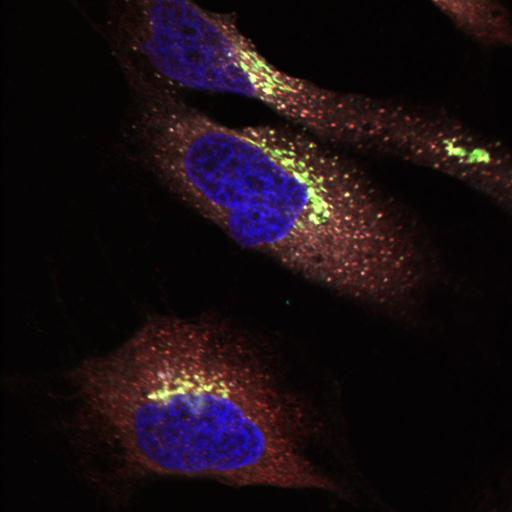  NCBI Organism:Homo sapiens; Cell Types:epithelial cell, ; Cell Components:Golgi stack, integral to membrane, Golgi cisterna membrane, nucleus, endoplasmic reticulum-Golgi intermediate compartment; Biological process:protein O-linked glycosylation via serine, protein O-linked glycosylation via threonine;