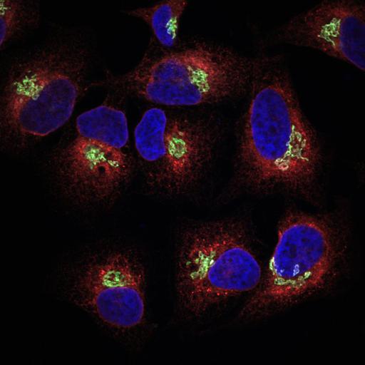  NCBI Organism:Homo sapiens; Cell Types:epithelial cell, ; Cell Components:Golgi stack, integral to membrane, nucleus, endoplasmic reticulum; Biological process:Golgi organization, protein folding in endoplasmic reticulum;