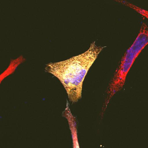  NCBI Organism:Homo sapiens; Cell Types:epithelial cell, ; Cell Components:Golgi stack, integral to membrane, endoplasmic reticulum, nucleus; Biological process:Golgi organization, protein folding in endoplasmic reticulum;