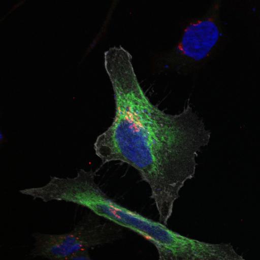  NCBI Organism:Homo sapiens; Cell Types:epithelial cell, ; Cell Components:Golgi stack, integral to membrane, endoplasmic reticulum, nucleus; Biological process:Golgi organization, protein folding in endoplasmic reticulum;