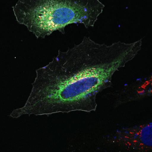  NCBI Organism:Homo sapiens; Cell Types:epithelial cell, ; Cell Components:Golgi stack, integral to membrane, endoplasmic reticulum, nucleus; Biological process:Golgi organization, protein folding in endoplasmic reticulum;