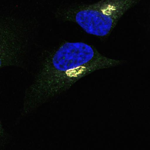  NCBI Organism:Homo sapiens; Cell Types:epithelial cell, ; Cell Components:Golgi cisterna membrane, nucleus, Golgi-associated vesicle, COPI vesicle coat; Biological process:retrograde vesicle-mediated transport, Golgi to ER, COPI coating of Golgi vesicle;