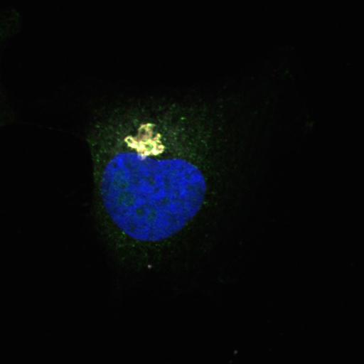  NCBI Organism:Homo sapiens; Cell Types:epithelial cell, ; Cell Components:Golgi cisterna membrane, nucleus, Golgi-associated vesicle, COPI vesicle coat; Biological process:retrograde vesicle-mediated transport, Golgi to ER, COPI coating of Golgi vesicle;